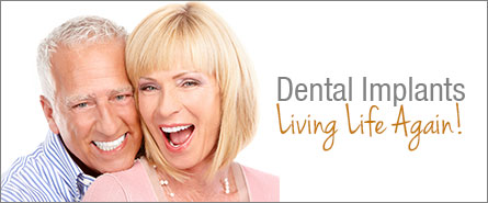 Dental Implants